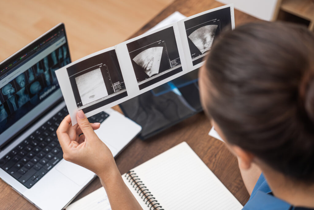 Ultrasound-Technology-Empowering-Healthcare