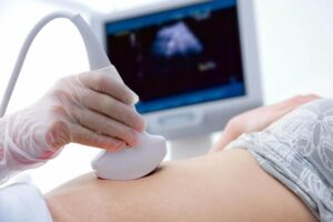 Ultrasound-Technology